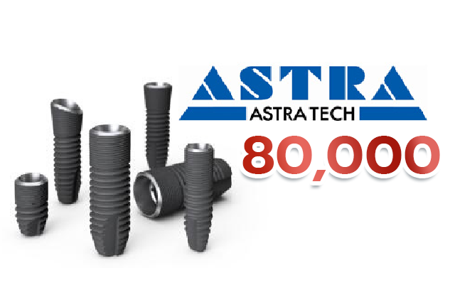 AstraTech Implant รากฟันเทียม