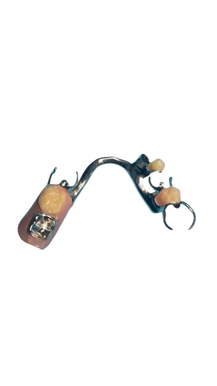 ฟันปลอมฐานโลหะ