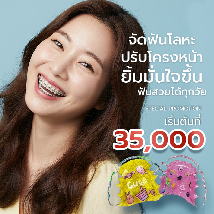 brace-treatment-silom-family