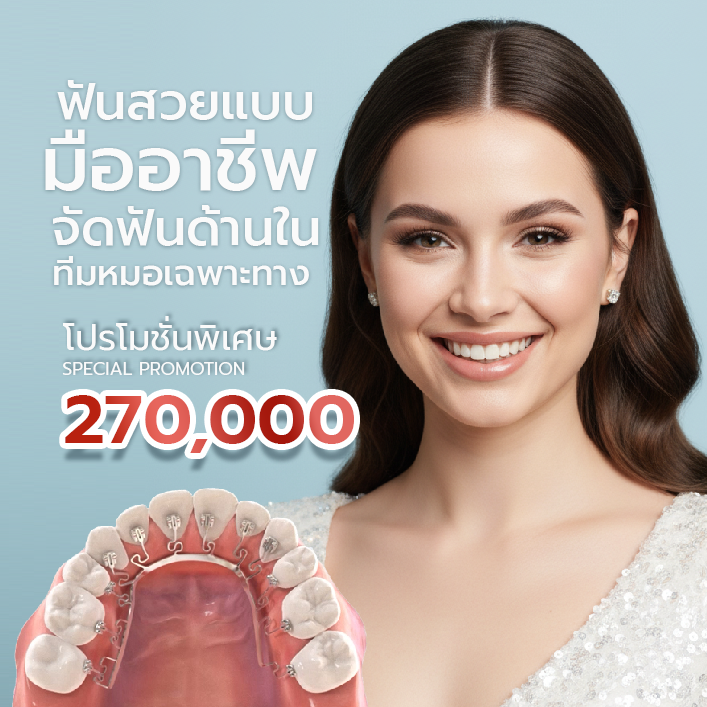 brava dental จัดฟันด้านใน