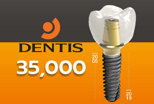 Dentis Implant รากฟันเทียม